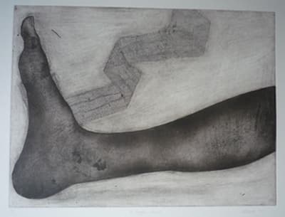 A Fragile Wound 7/15 by Christine Dixie